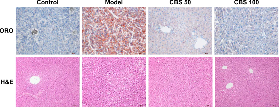 Figure 3 OrO and h&e staining of mouse livers.Notes: effects of cBs (50 and 100 mg/kg) on fructose-induced lipid accumulation and macrovesicular steatosis