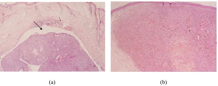 Figure 1.  Stained slides, magnification 2.5, used for diagnosis of  (a) BCC and (b) 