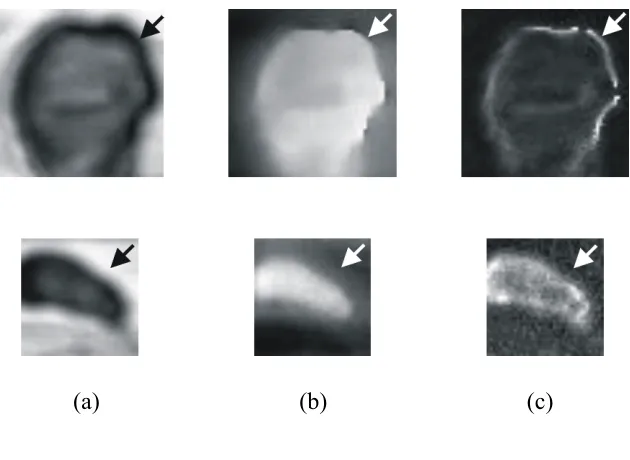 Figure 3. Time domain parametric images for the BCC (top row) and melanoma (bottom 