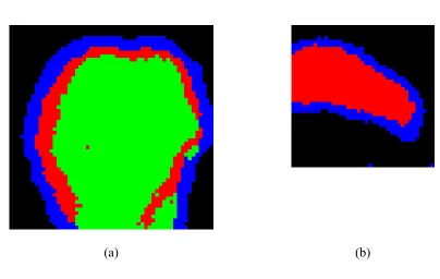 Figure 4. Classifications resulting from three parametric images, using the unsupervised 