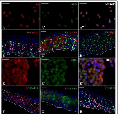 Fig. 4 Double immunofluorescent analysis of E6 and E7 with cyclin E2 and B1. E6 and E7 HPV16 pushes a subset of differentiating cells into G1/Sand differentiated layers