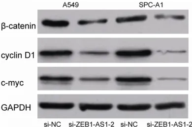 Figure 4. LncRNA ZEB1-AS1 inhibition suppressed NSCLC cell invasion and angiogenesis. A