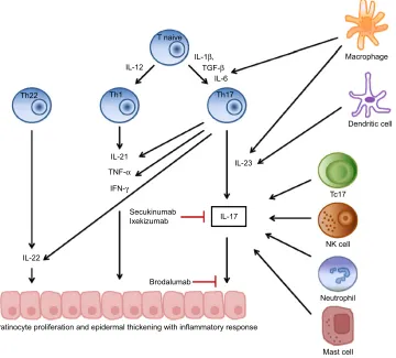 Figure 1 interleukin (iL)-17 in the pathogenesis of psoriasis and targets for brodalumab, secukinumab, and ixekizumab.Note: Copyright ©2014