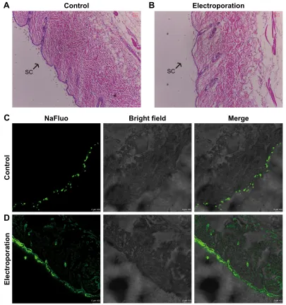 Figure 6 effect of electroporation on mice skin structure.Notes: The analysis of he staining in control groups (A) and in electroporation groups (B)