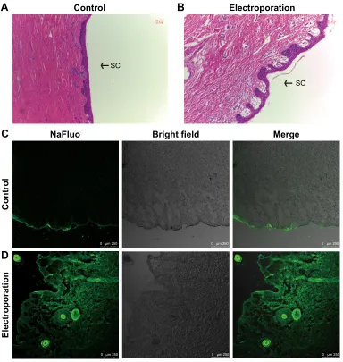 Figure 8 The mechanism of electroporation enhancing sh transdermal delivery.Notes: (A) in control, the overall skin was tight and integrated