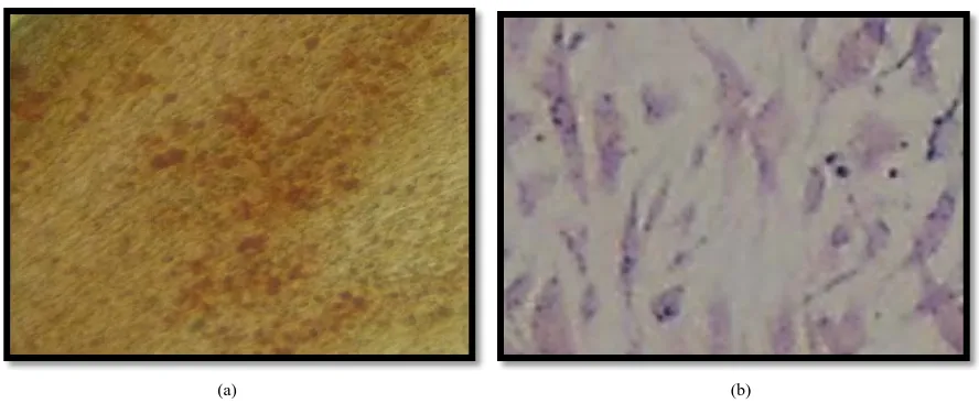 Figure 7. Osteoblast like cells from hPBSCs, adherent cells at 21 days were directly induced by pouring osteogenic medium (Gibco USA) to osteoblast cell line, cells stained positive for both Alizarin red (a) and Alkaline phosphatase (b) ×200