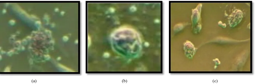 Figure 1. Inverted phase-contrast micrographs showing the morphologies of primary and second generation peripheral blood-derived like mesenchymal stem cells cultured for 5 days (a) and 7 days (b) and 10 days (c) (original magnification ×100- 200-400)