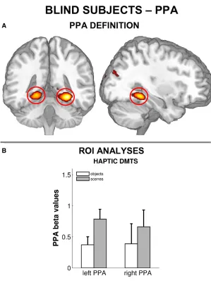 Figure 3. Haptic Scene Processing in the PPA of BlindSubjects