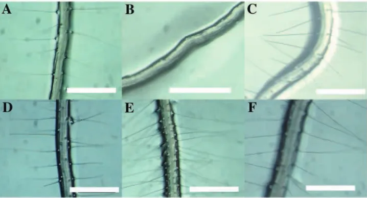 Fig. 1. Root hair phenotypes of 5-day old seedlings: (A) Columbia ecotype, (B) 10axr3-1, (C) axr3-, (D) Landsberg erecta (Ler) ecotype, (E) shy2-2 and (F) shy2-31