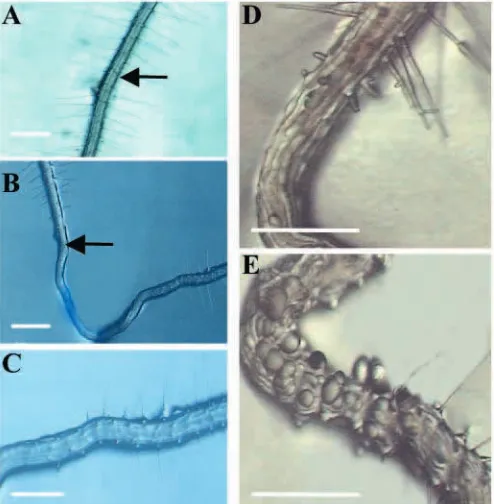 Fig. 5. Mean root hair length at four time points: 4,transgene induction from the heat shock promoter(HS)