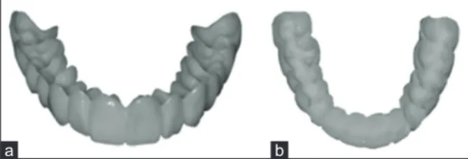 Figure 2: The esthetic device. (a) Front view, (b) inside view b
