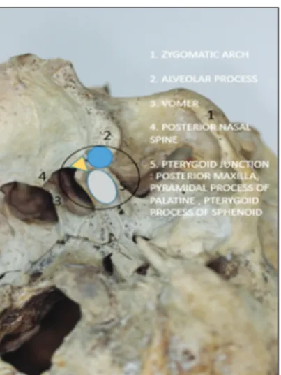 Figure  1: The base of the skull view showing the landmarks of  interest