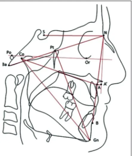 Figure  1:  A  template of tracing by which cephalometric  measurements were evaluated