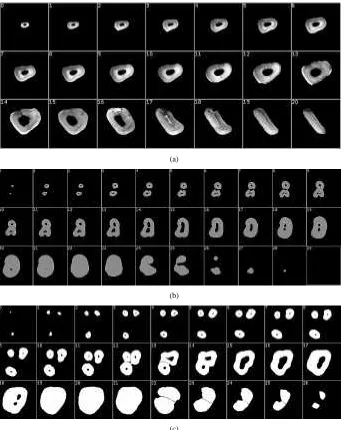 Fig. 6.Segmented and aligned tooth slice sets. (a) Incisor. (b) Premolar (two roots). (c) Molar (three roots).