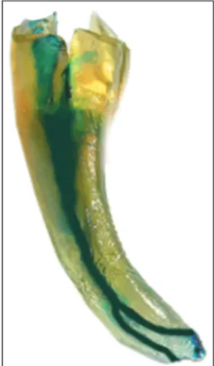 Figure 4: Th e cleared teeth aft er the dye has been injected