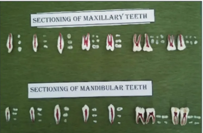 Figure 5: Sectioned teeth both maxillary and mandibular