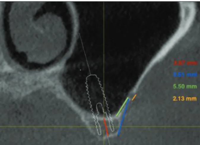 Figure 1: Cone beam computed tomography measurements