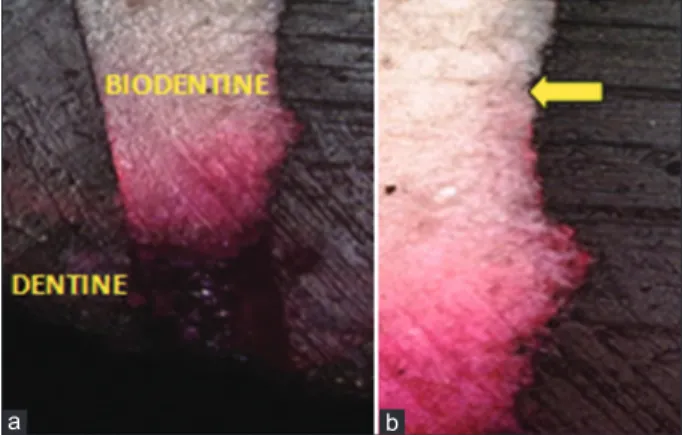 Figure 2: Confocal image of Group I (B) sample showing dye  penetration, (a) ×10 image, (b) ×20 image