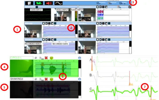 Fig. 9. Visual feedback in the GIDE system (top). A video of the original recorded image (1) is shown on the left hand side of the view for each gesture, together with a visualization of the waveform (2)
