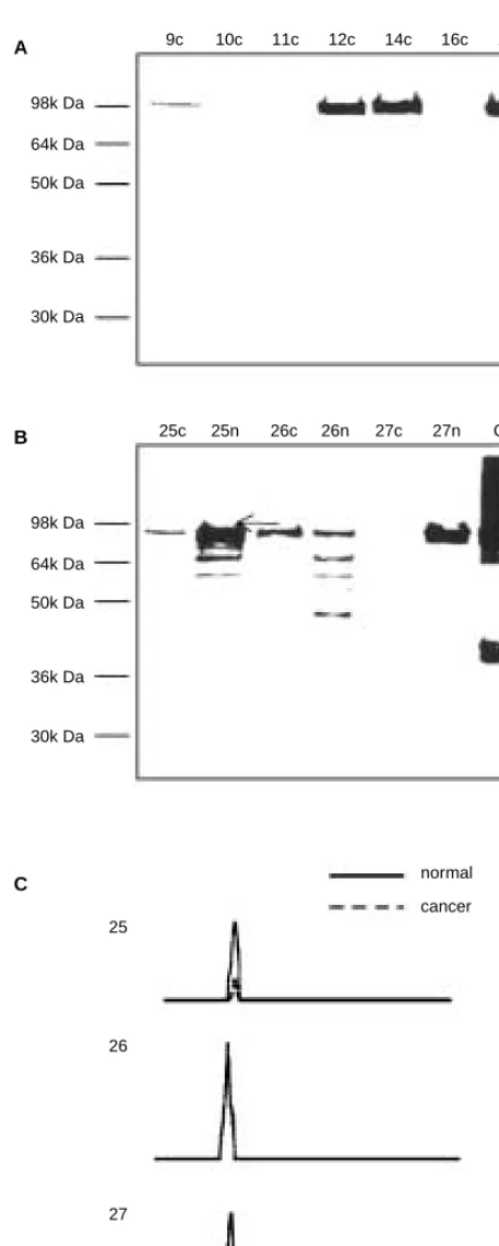 Figure 3Western blot analysis of TPO in thyroid cancer tissue after conditions probed with anti-TPO mAb#47