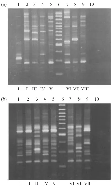 Fig. 1. Summary of DNA ﬁngerprints fromare indicated at bottom of lanes. On both gels: laneisolates from both patients and the environment on wards Aand B using RAPD–PCR technique (technique (Metaphor C