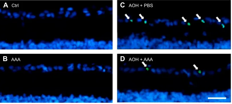 Figure 1 aaa attenuates aOh-induced retinal apoptosis.Notes: TUnel (A–D) stainings were performed after 5 days of AOH