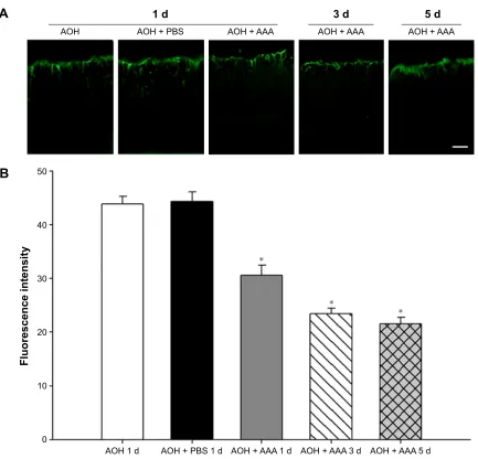 Figure S3 increased gFaP immunoreactivity after aOh induction in rat retinas.Notes: (A) Immunofluorescent staining showed that AOH increased GFAP immunoreactivity in the Müller cell processes across IPL