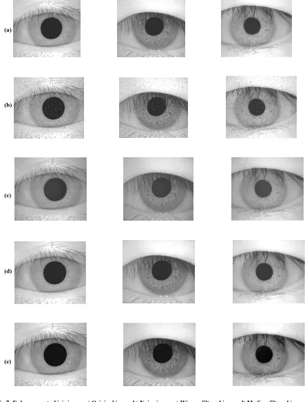Fig 7: Enhancement of iris image a) Original image b) Noisy image c) Wiener-filtered image d) Median-filtered image e) Enhancement using proposed method (IEHFS)