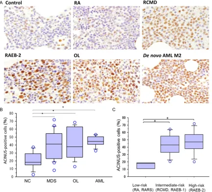 Figure 1. Strong expression of ACINUS in bone marrow cells of MDS and AML. A. Immunohistochemistry of ACINUS in control, MDS, MDS-OL, and de novo AML bone marrow (×400, original magnification)