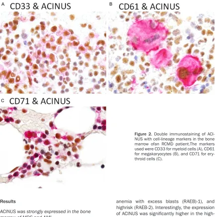 Figure 2. Double immunostaining of ACI-NUS with cell-lineage markers in the bone 