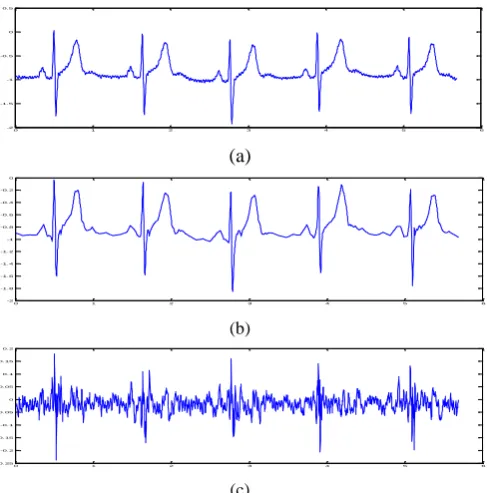 Table 8. A comparison of the average of PRD and CR based on the different wavelets and iterations of quantization Iteration Wavelet PRD (%) CR (%) 