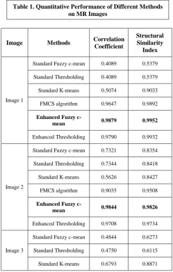 Figure 3.Performance analysis of various segmentation algorithms on MR brain image (a) Original image (b) ROI 