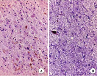Table 2 Semiquantitative estimation of the severity ofneuropathologic lesions