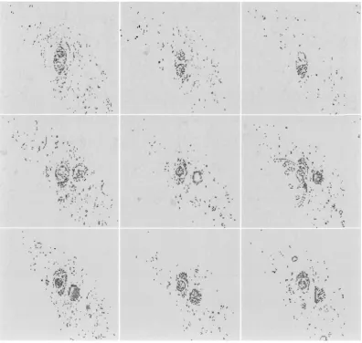 Fig. 9.Vessel segmentation in the selected frames using classical statistics-based RBF training.