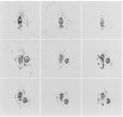 Fig. 10.Vessel segmentation in the selected frames using alpha-trimmed mean RBF training.
