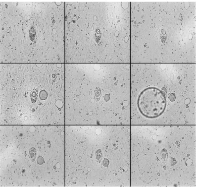 Fig. 8.Frames from a stack of microscopy images representing cross-sections of tooth pulpal blood vessels and surrounding tissue.