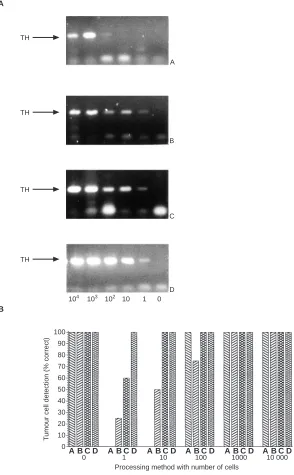 Figure 1Sensitivity of RT-PCR for the detection of known numbers of IMR-32 cells in whole blood spikes by RT-PCR for TH mRNA