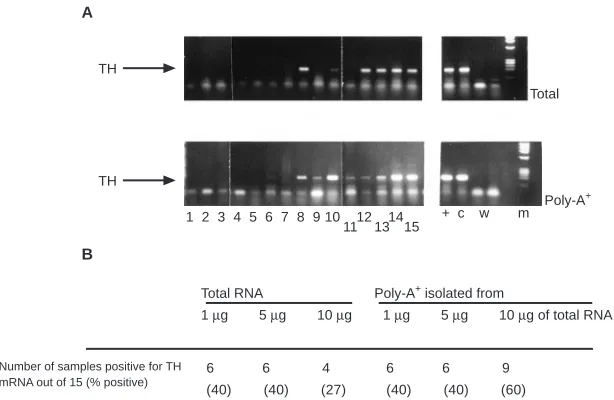 Table 1Sensitivity and frequency of IMR-32 cell detection in whole blood spikes