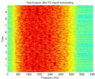 Fig 11: Spectrogram of Denoised power quality signal  