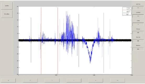 Fig. 5 : Graph representing force platform signal with the first component of accelerometer The two signals on the graph are not good synchronize to show corresponding peaks on the both signals