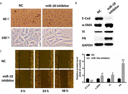 Figure 2. Inhibition of miR-18 prompts the process of EMT and cell migration. A. The cells demonstrated an elon-gated and spindle-shaped morphology after transfection with miR-18 inhibitor for 48 h