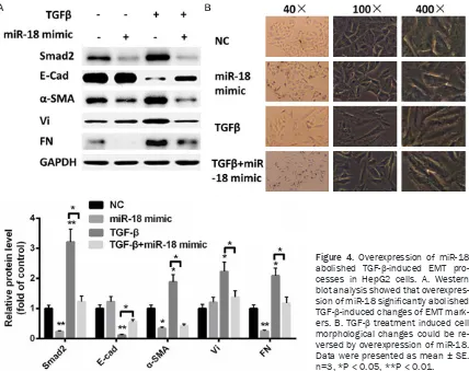Figure 4. Overexpression of miR-18 abolished TGF-β-induced EMT pro-cesses in HepG2 cells