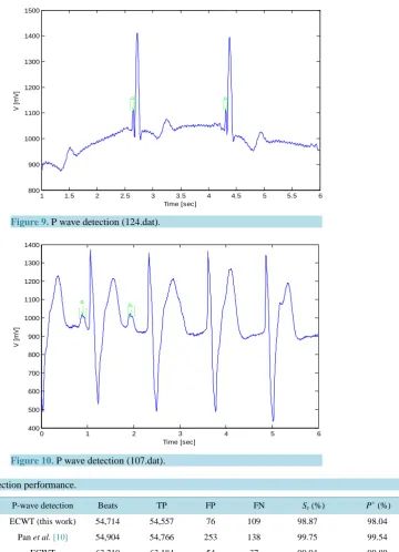 Figure 9. P wave detection (124.dat).                                   