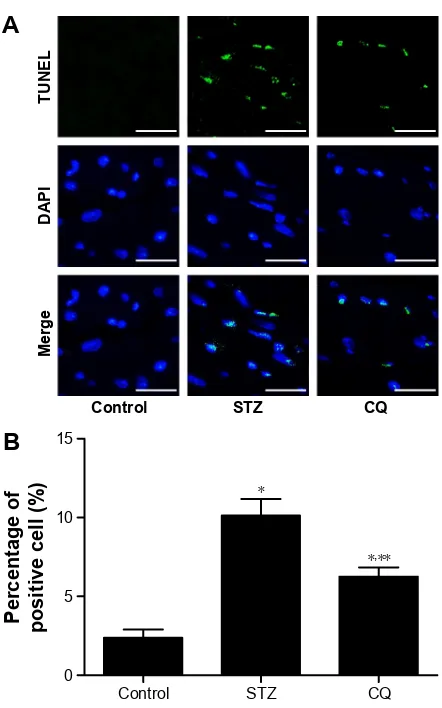 Figure 8 Effects of CQ on cardiac fibrosis in STZ-induced mice.Notes: CQ attenuated cardiac fibrosis in STZ-induced mice