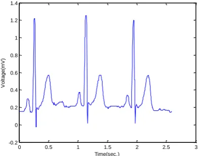 Fig. 3 Plot of extracted data of record NR1 