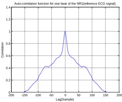 Fig. 5(a) ECG trace of NR2 