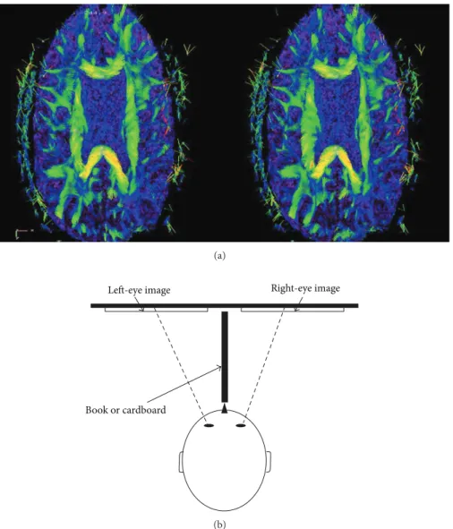 Figure 2: 3D visualization tool. Stereoscopic left- and right-eye-image generated by the visualization tool; one can achieve the stereo effect by focusing beyond the image plane or with the help of a stereoscope, or by using a piece of cardboard put betwee