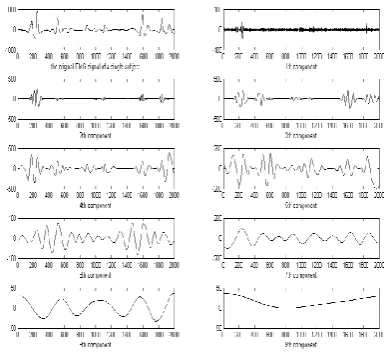 Figure 2: An EMG trial along with its decomposed IMF components, are depicted. The frequency of these IMFs is 