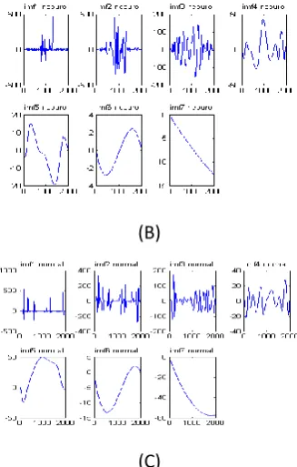 Figure 3: the result of applying EMD procedure to EMG data A. subject with myopathy disorder B