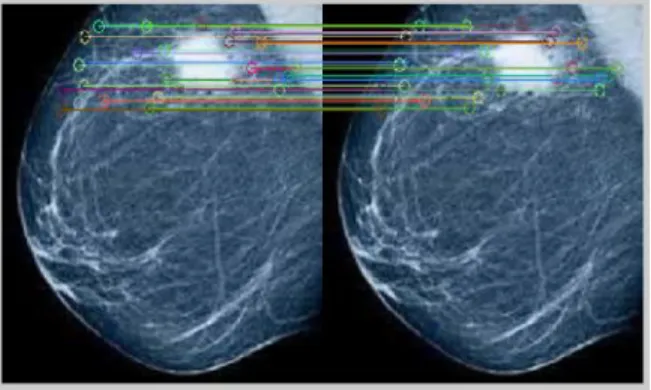 Fig.  2.  Matching  SIFT  features  using  exhaustive search